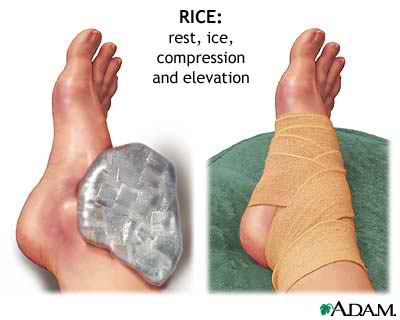 rest ice compression elevation