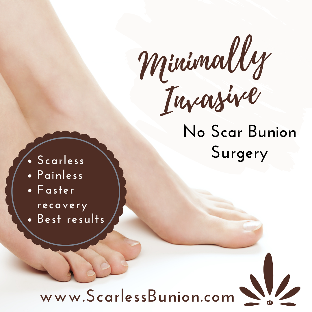 No Scar Bunion Surgery